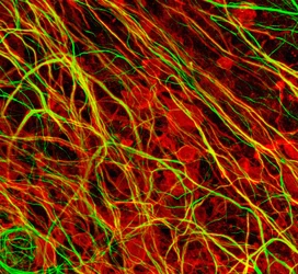 El aislante de los cables del pensamiento 